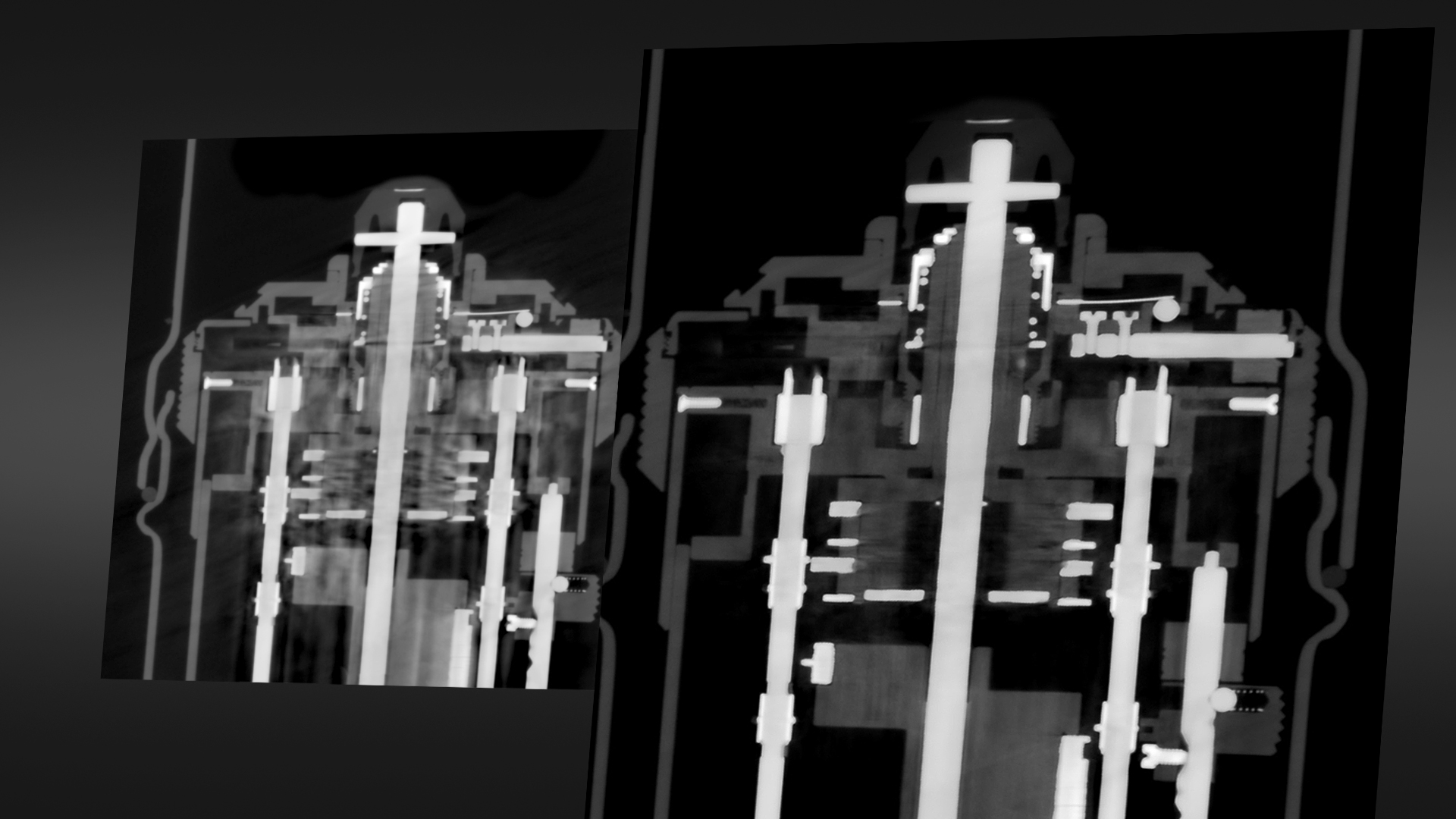 고급 혼합 자재 인공물 감소(AMMAR)