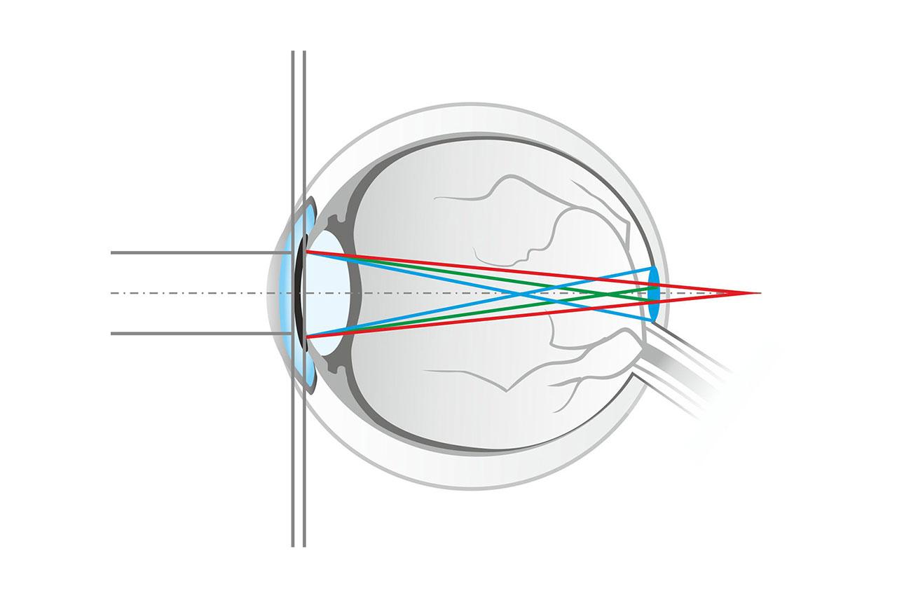 청색광 필터를 적용한 무색 안경 렌즈